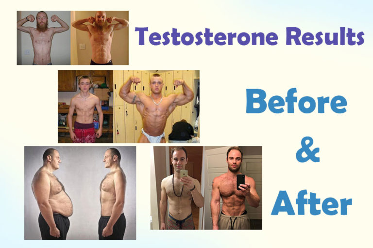 Treatment Of Low Testosterone Before And After Hrtus 0852